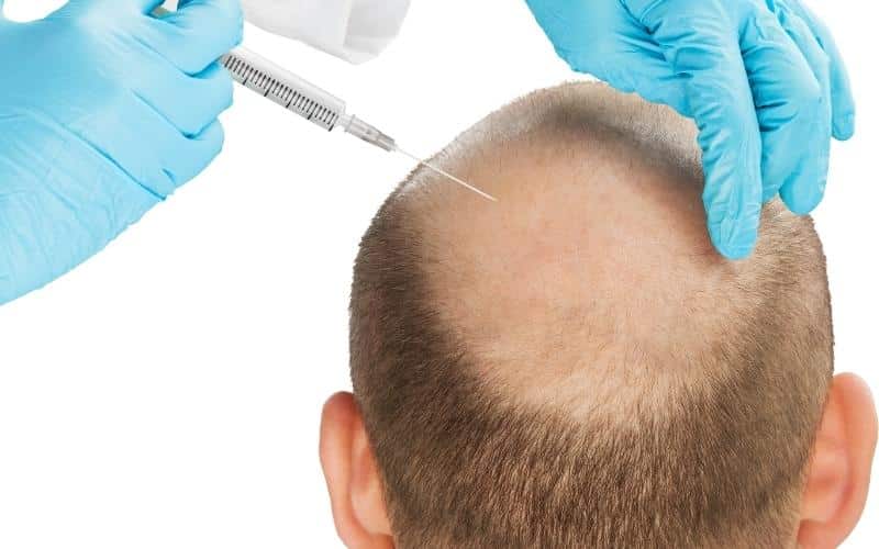 Hair Transplant Clinic in Ongole